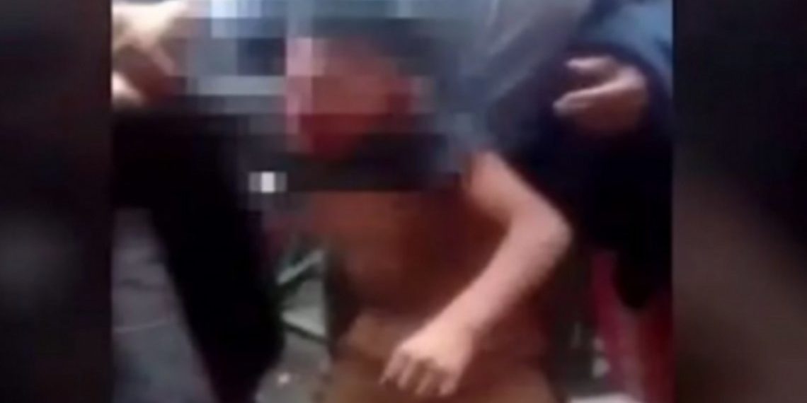 Salta: un nene gastó 20 pesos en golosinas y su mamá le fracturó el cráneo con un machete