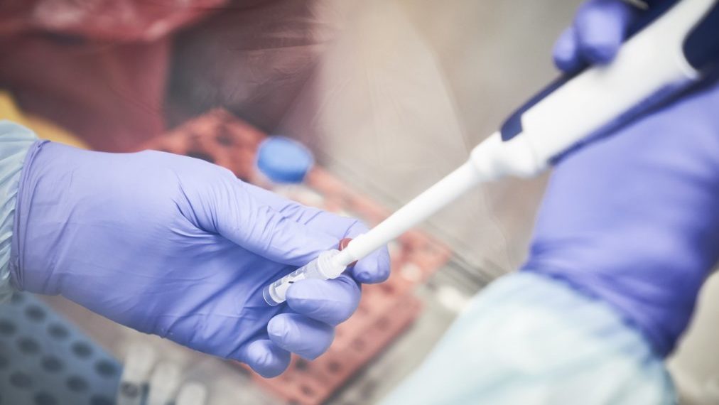 Coronavirus: llegaron al país 31 mil reactivos para descentralizar el diagnóstico