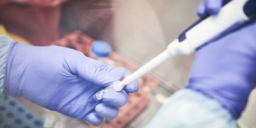Coronavirus: llegaron al país 31 mil reactivos para descentralizar el diagnóstico