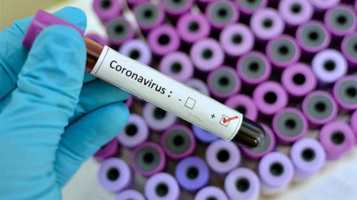Confirmado el primer caso de Coronavirus en Foz de Iguazú