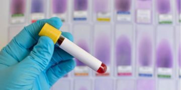 Chaco informó el posible primer caso autóctono de coronavirus
