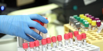 La OMS eligió a Argentina y otros nueve países para ensayos contra el coronavirus
