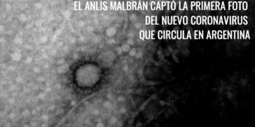 Coronavirus: el Malbrán consiguió la primera foto del virus que circula en el país