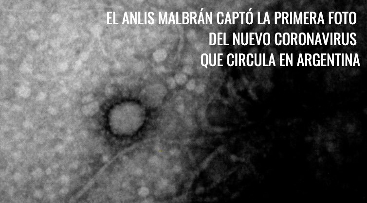 Coronavirus: el Malbrán consiguió la primera foto del virus que circula en el país