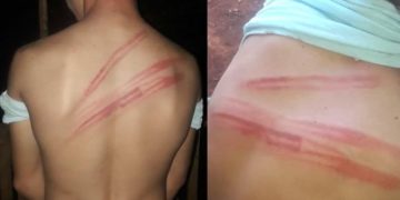Andresito: pasaron a disponibilidad a siete policías por la presunta agresión a un joven
