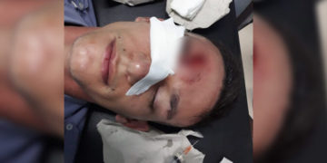Violenta gresca dejó tres policías heridos y varios detenidos en el barrio A-4