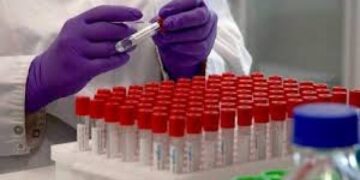 Investigadores argentinos desarrollaron un suero terapéutico anti COVID-19 que en pruebas de laboratorio neutralizó el virus