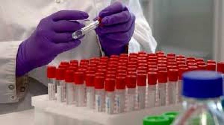 Investigadores argentinos desarrollaron un suero terapéutico anti COVID-19 que en pruebas de laboratorio neutralizó el virus