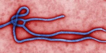 Bolivia: apareció un virus letal similar al Ébola y ya enciende las alarmas sanitarias del mundo