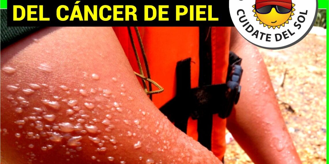 Finaliza Campaña de Prevención del Cáncer de Piel 2020