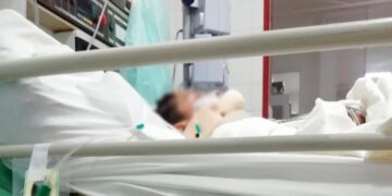 Aumento de accidentes viales genera alarma por la demanda de camas en los hospitales