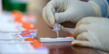 Covid: aprobaron la venta en farmacias de un test rápido que ronda los $2.600