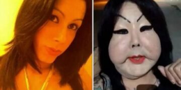 Se aplicó silicona industrial en la cara y quedó desfigurada