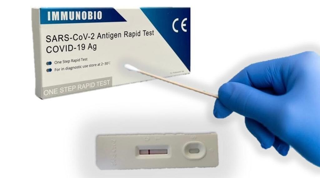 Reiteran que el test rápido para detección de Covid-19 de venta libre sólo puede ser realizado por un profesional autorizado