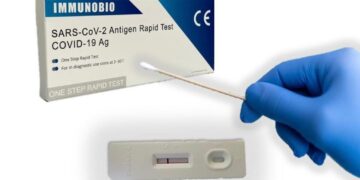 Reiteran que el test rápido para detección de Covid-19 de venta libre sólo puede ser realizado por un profesional autorizado