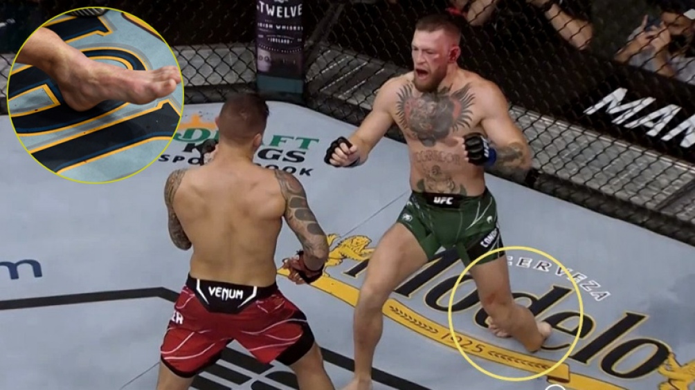 Conor McGregor fue operado con éxito de la fractura y volvió a desafiar a Poirier