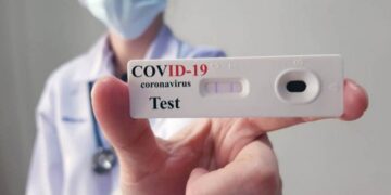 Los primeros autotest estarían disponibles la próxima semana en farmacias, a 1.560 pesos