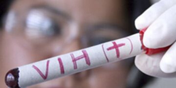 Prueban en humanos una vacuna contra el VIH