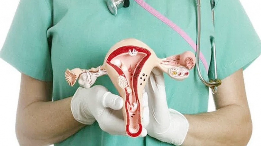 Nueve de cada diez casos de cáncer uterino se podrían prevenir con control ginecológico