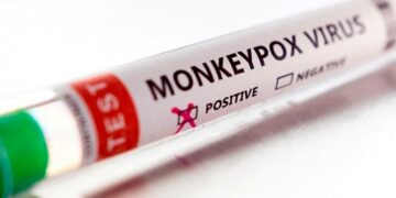 La OMS confirmó 780 casos de viruela del mono en 27 países donde el virus no es endémico