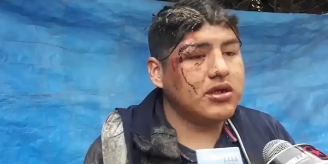 Lo enterraron vivo como ofrenda a la Pachamama