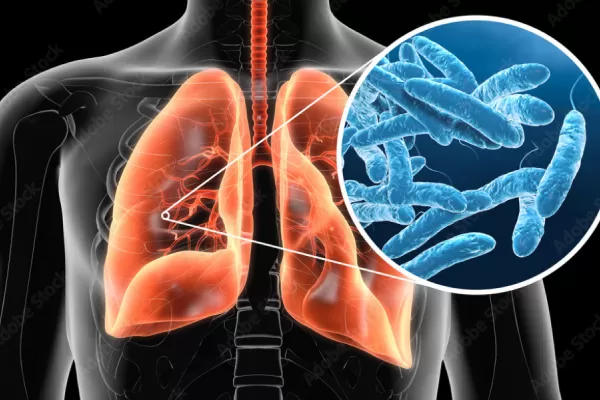Tucumán: ya son seis las víctimas fatales por Legionella