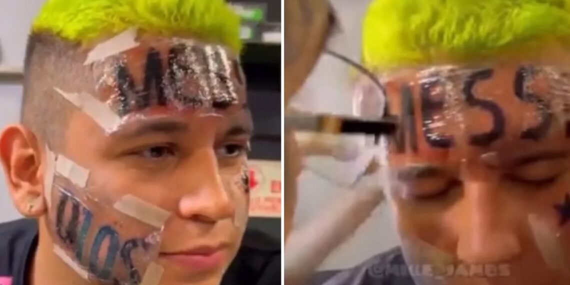 El joven que se tatuó “Messi” en la frente tras la final del Mundial ya se arrepintió: “Me lo quiero borrar”