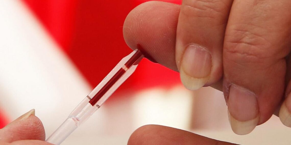 Más de 140 mil personas viven con VIH Sida en la Argentina y no descendió la mortalidad