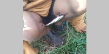 Fue a pescar y terminó lesionándose con el señuelo