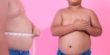 Día Mundial de la Obesidad: sin ayuda médica, habrá un colapso del sistema de salud en pocos años