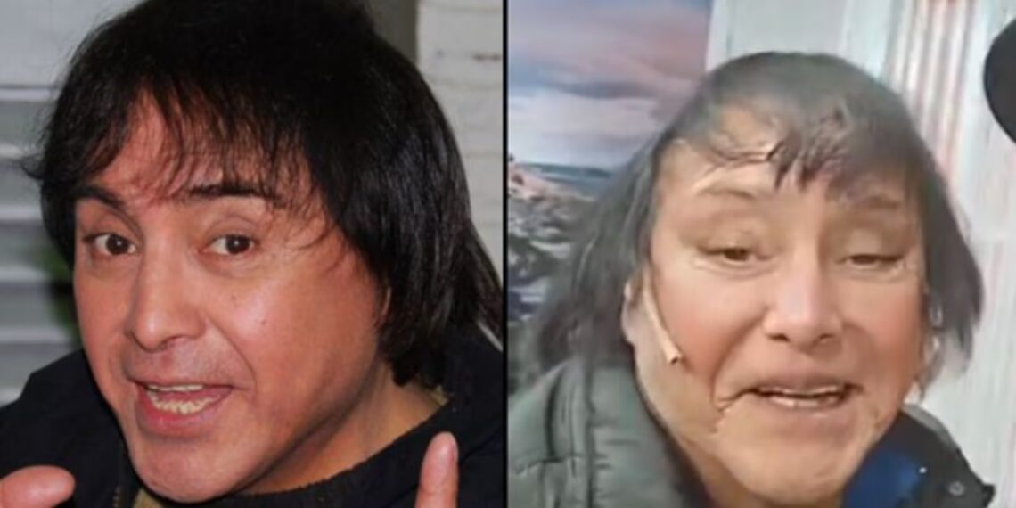 Aseguran que le bloquearon las cuenta bancarias a Ricky Maravilla por su operación de rostro: qué dijo el artista