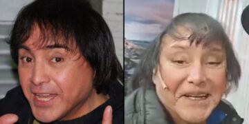 Aseguran que le bloquearon las cuenta bancarias a Ricky Maravilla por su operación de rostro: qué dijo el artista