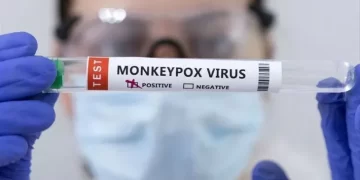 Alerta máxima: La OMS declaró la viruela del mono como emergencia internacional