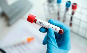 Condenaron a un hombre por contagiar con HIV a su ex pareja