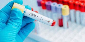 Alarma por un récord de contagios de sífilis en Argentina: el NEA entre las más afectadas