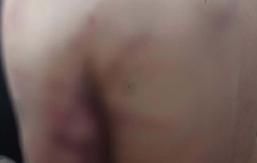 Golpeó brutalmente a su hijo y ahora es intensamente buscado por la Policía