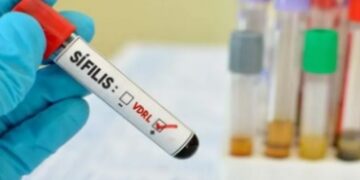 Alarmante: la sífilis suma nuevos contagios en Argentina y marca un nuevo récord de casos