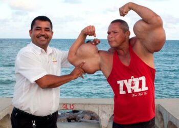 Murió “Popeye”, el fisicoculturista brasileño que se inyectaba aceite para tener unos bíceps de 73 centímetros
