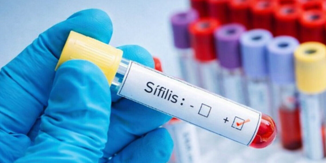 Alerta sanitaria: durante el 2025 los casos de sífilis aumentaron más del 70 por ciento