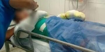 Un adolescente fue internado por quemaduras graves en el 60% de su cuerpo tras la explosión de su celular