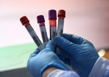 Día Mundial de la Hemofilia: por qué un simple golpe puede volverse un riesgo serio