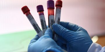 Día Mundial de la Hemofilia: por qué un simple golpe puede volverse un riesgo serio